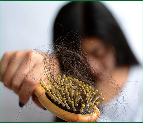 Ayurvedic Treatment for Hair Loss